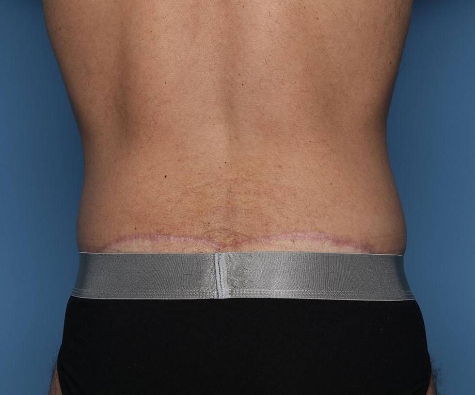 Rear View After thumbnail