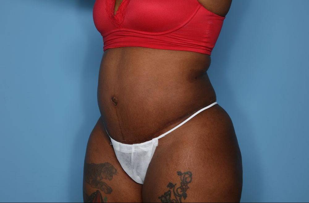 After thumbnail