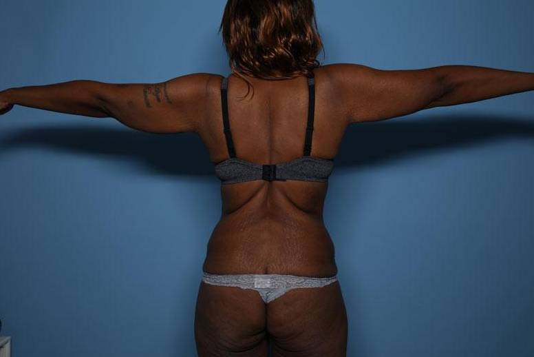 Rear View Before thumbnail