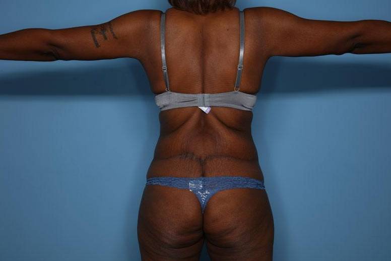 Rear View After thumbnail
