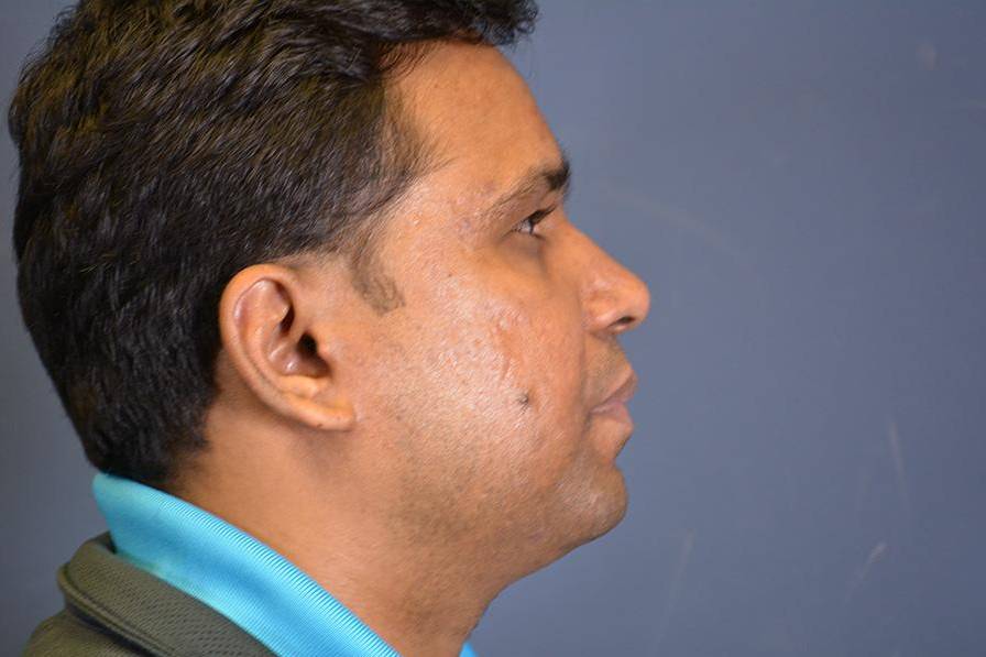 After image