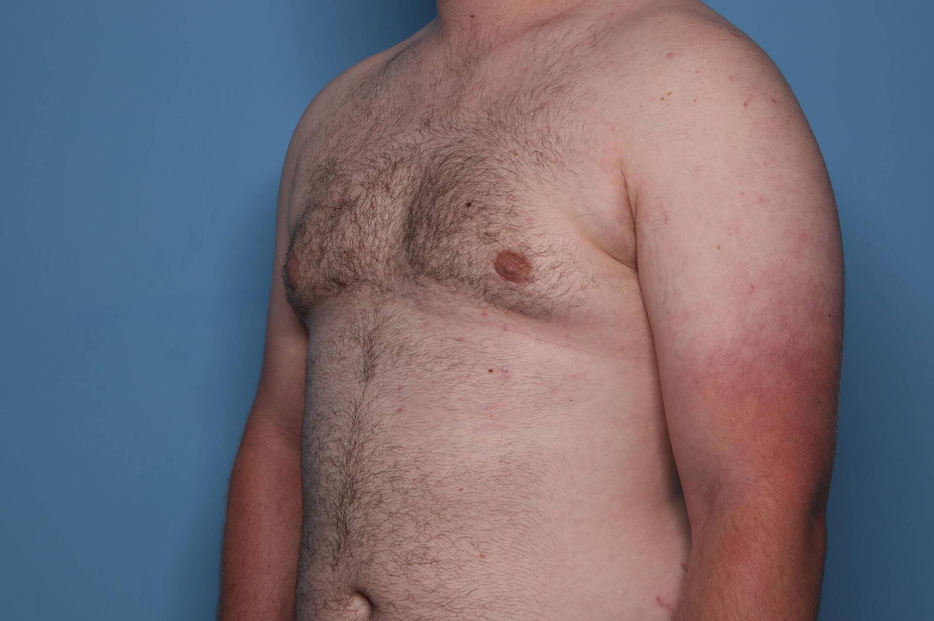 After thumbnail