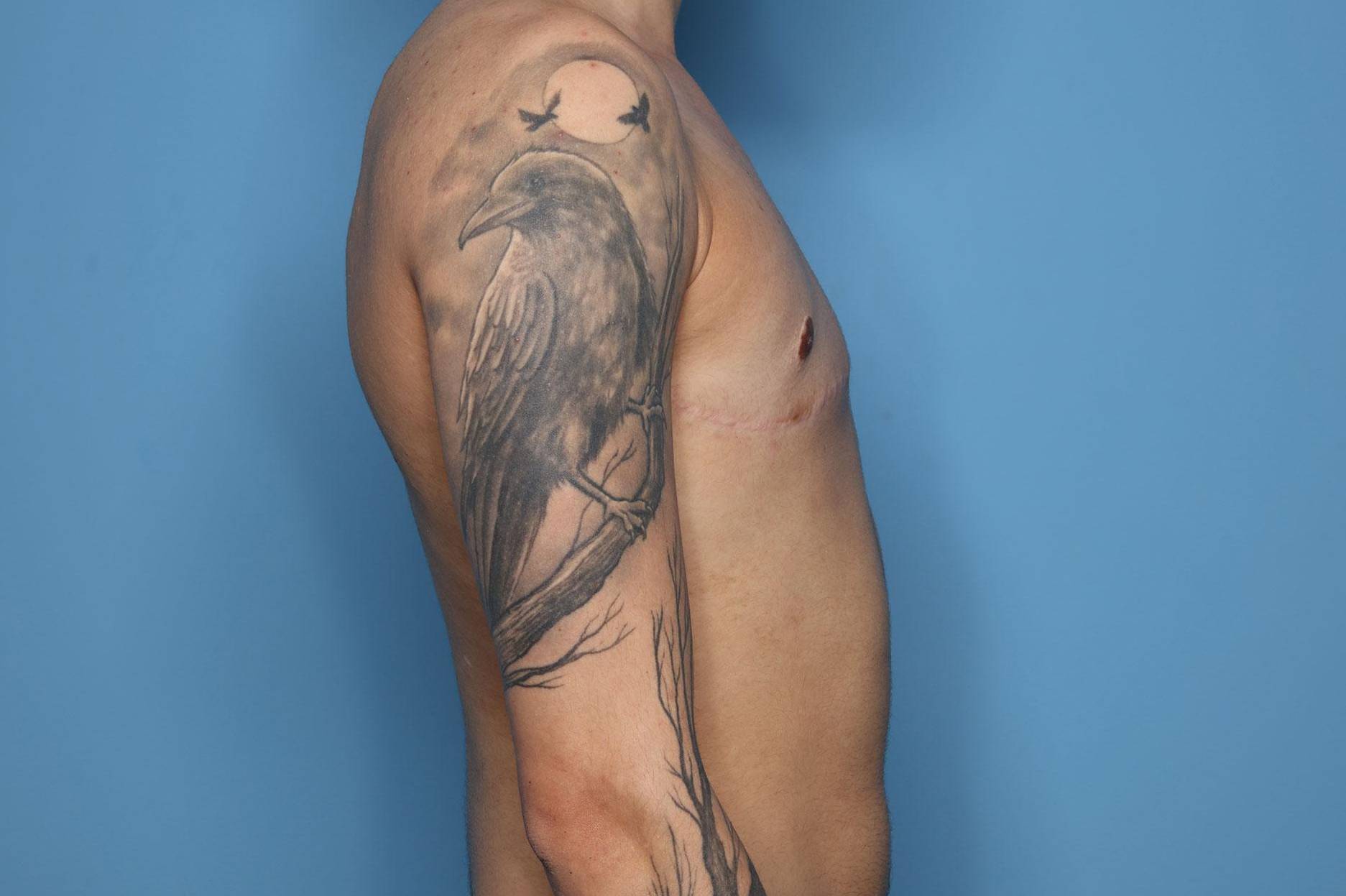 Right View After thumbnail
