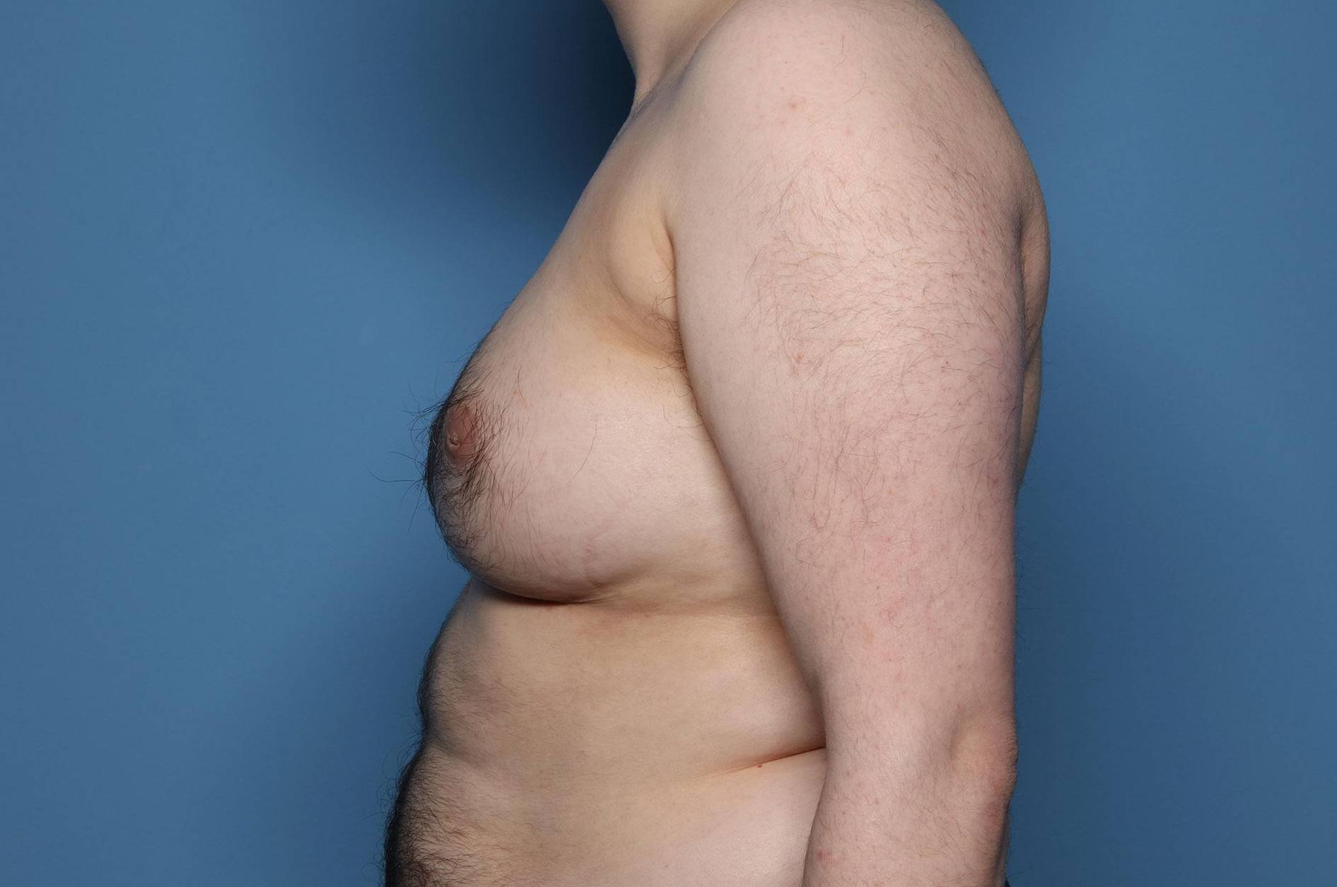 Before thumbnail