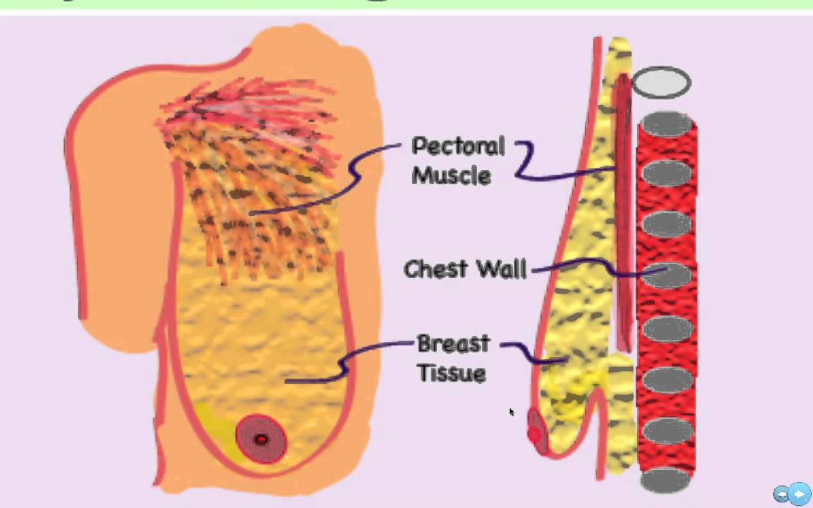 West County Plastic Surgeons Seminar: Breast Augmentation and Lift